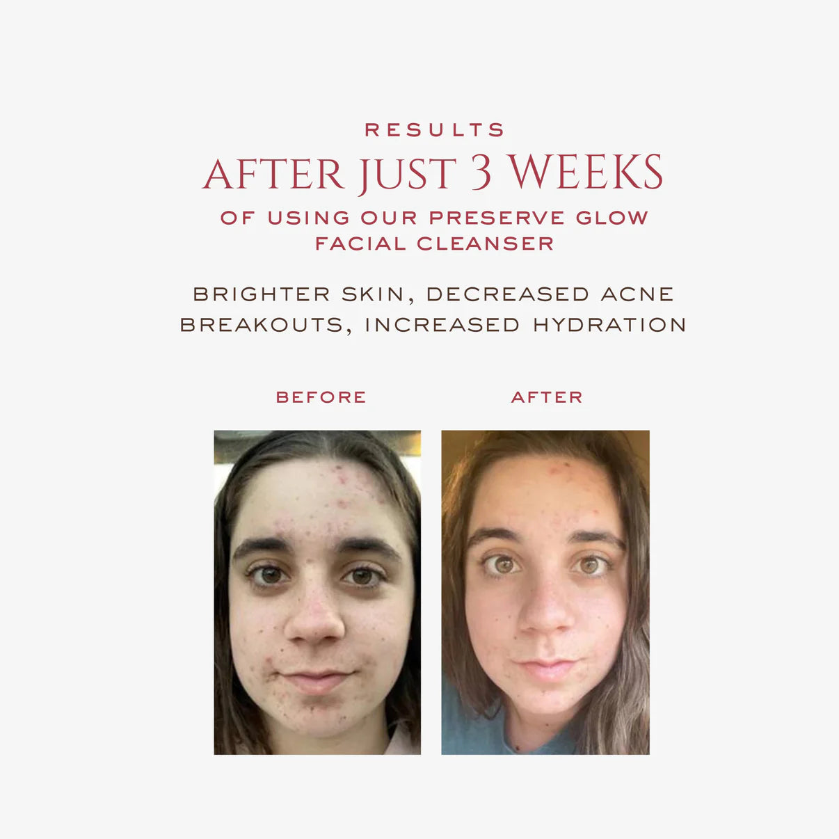 Glow Kit | Teen & Tween Bundle - Heirloom Beauty