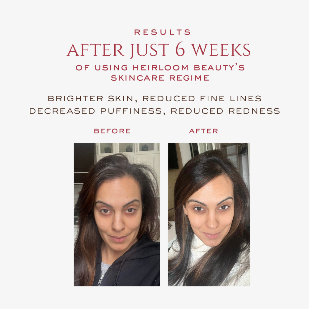 LED Light Therapy Face Mask - Heirloom Beauty