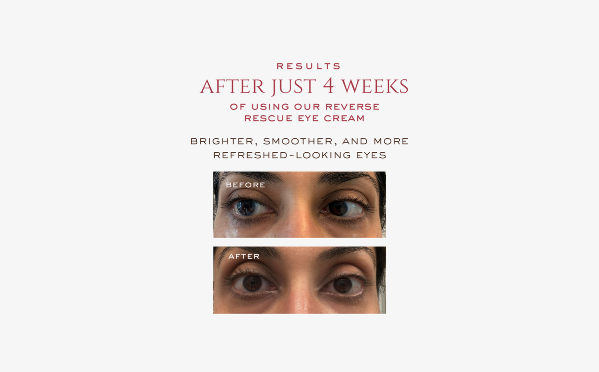 Reverse Rescue Eye Cream