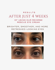 Reverse Rescue Eye Cream