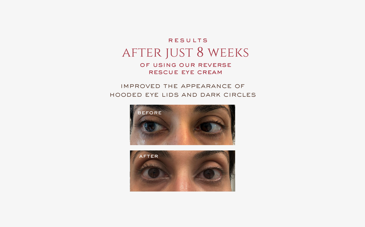 REVERSE Rescue Eye Cream