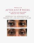 REVERSE Rescue Eye Cream